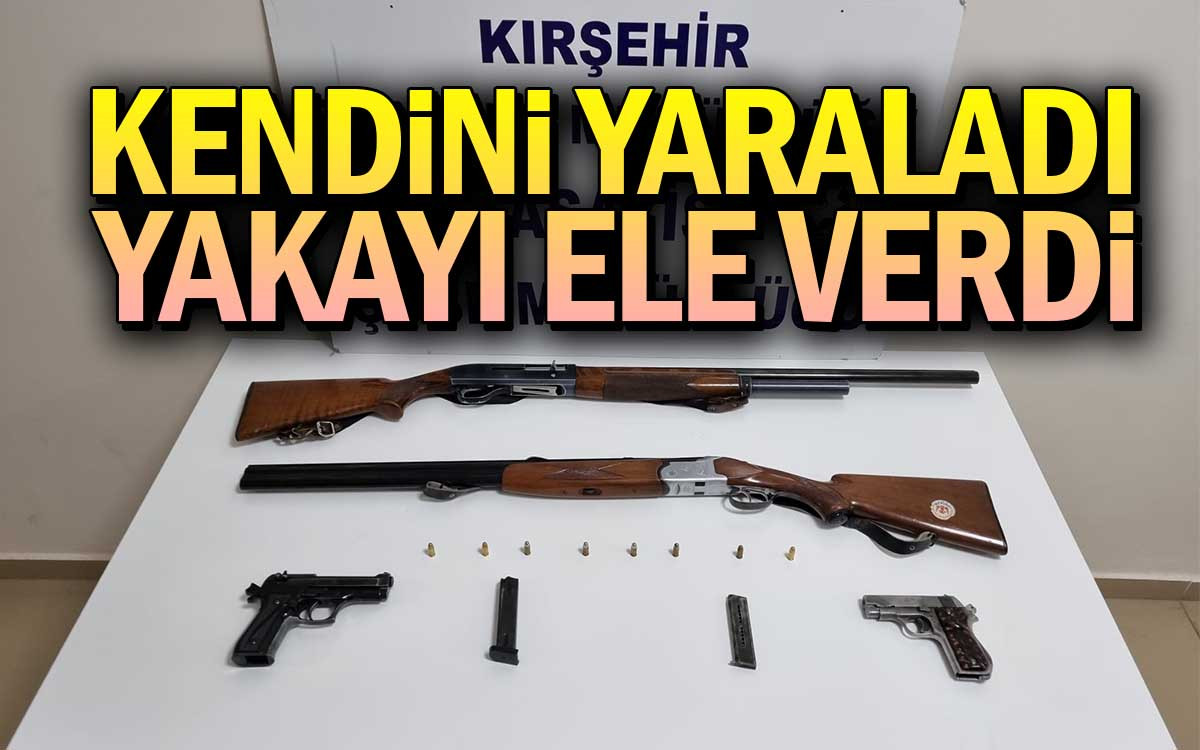 Kendini Yaraladı Yakayı Ele Verdi