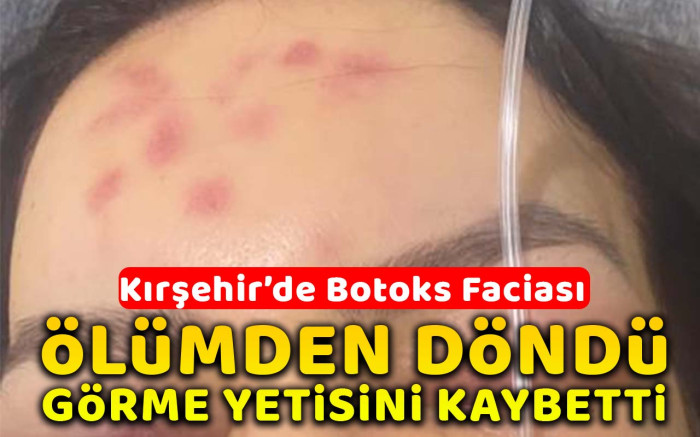 Yanlış botoks işlemi yüzünden görme yetisini kaybetti